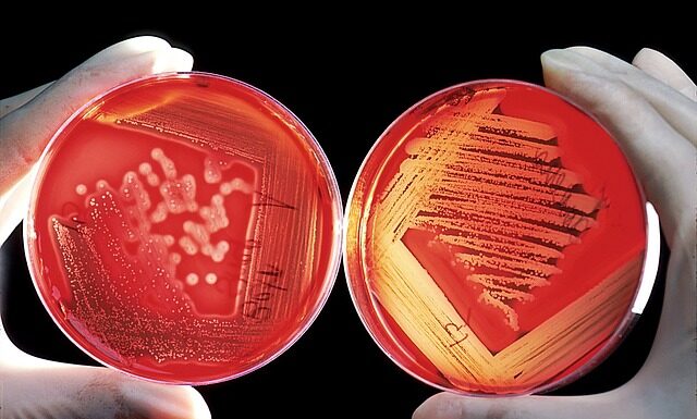 Jakim klejem przykleić wygłuszenie pod maską?